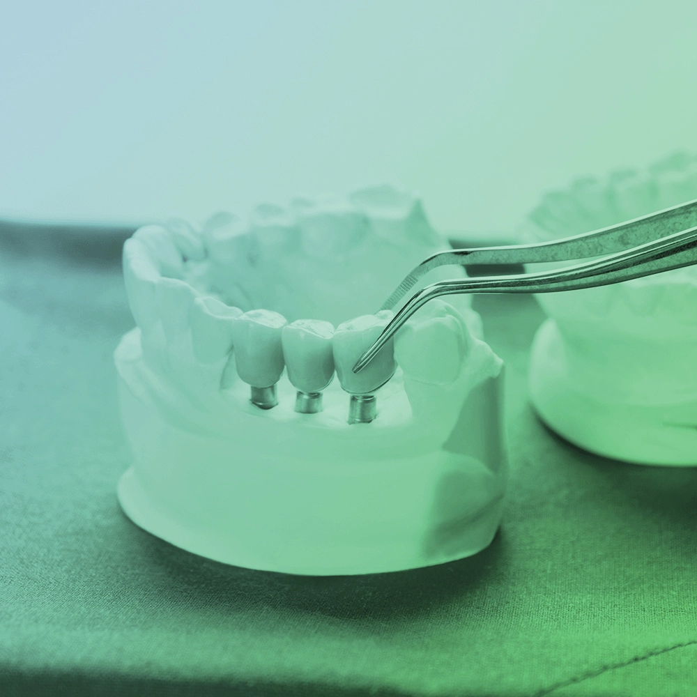 Crowns being placed on a denture model.