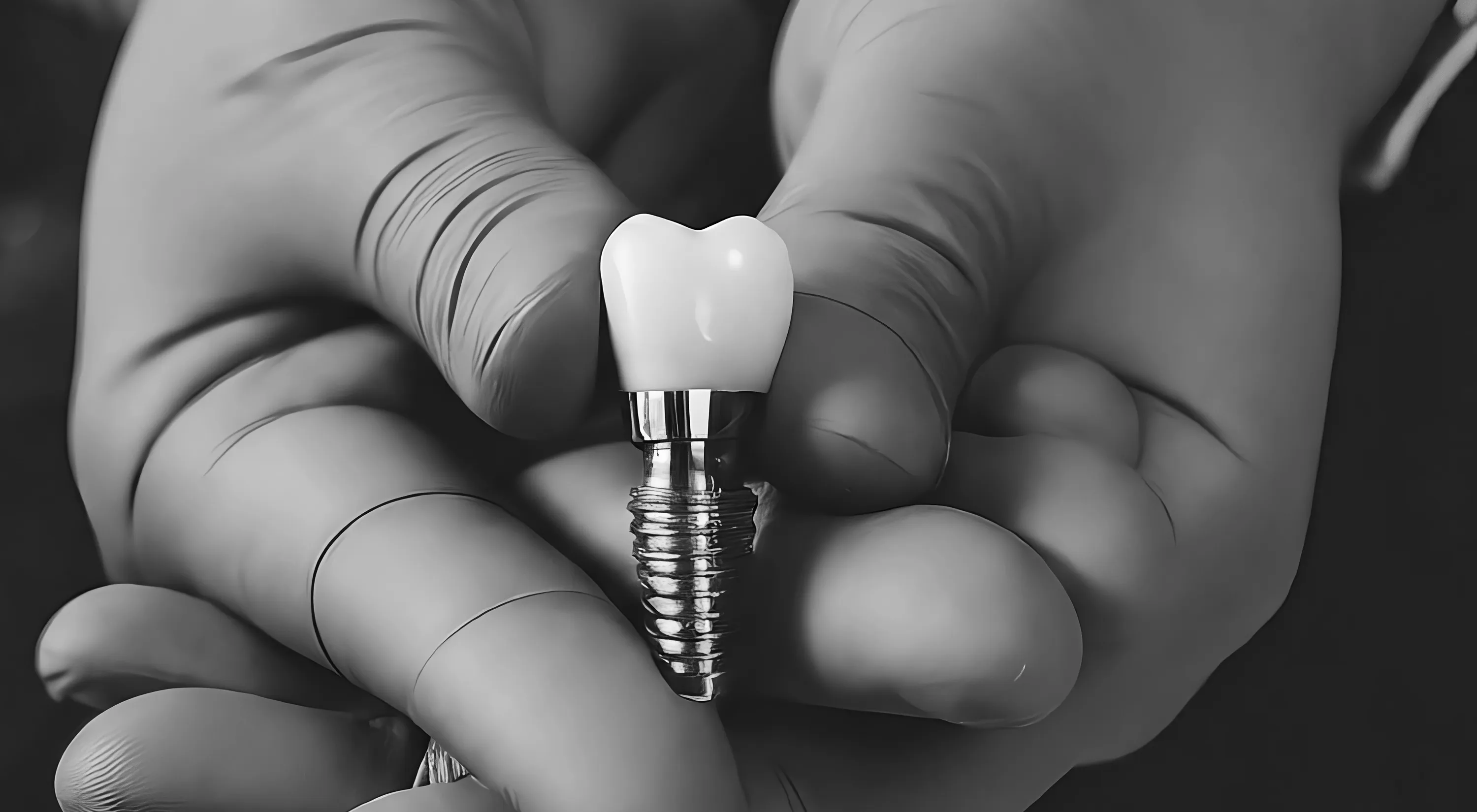 A close-up of gloved hands holding a dental implant.
